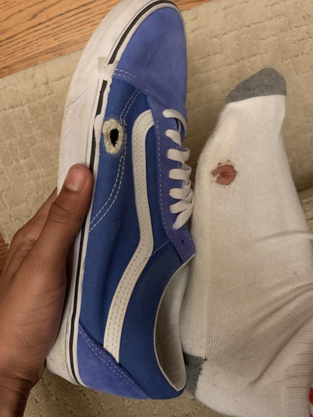 r/NewSkaters - Hole in shoes after 5 minutes of practicing my ollie.