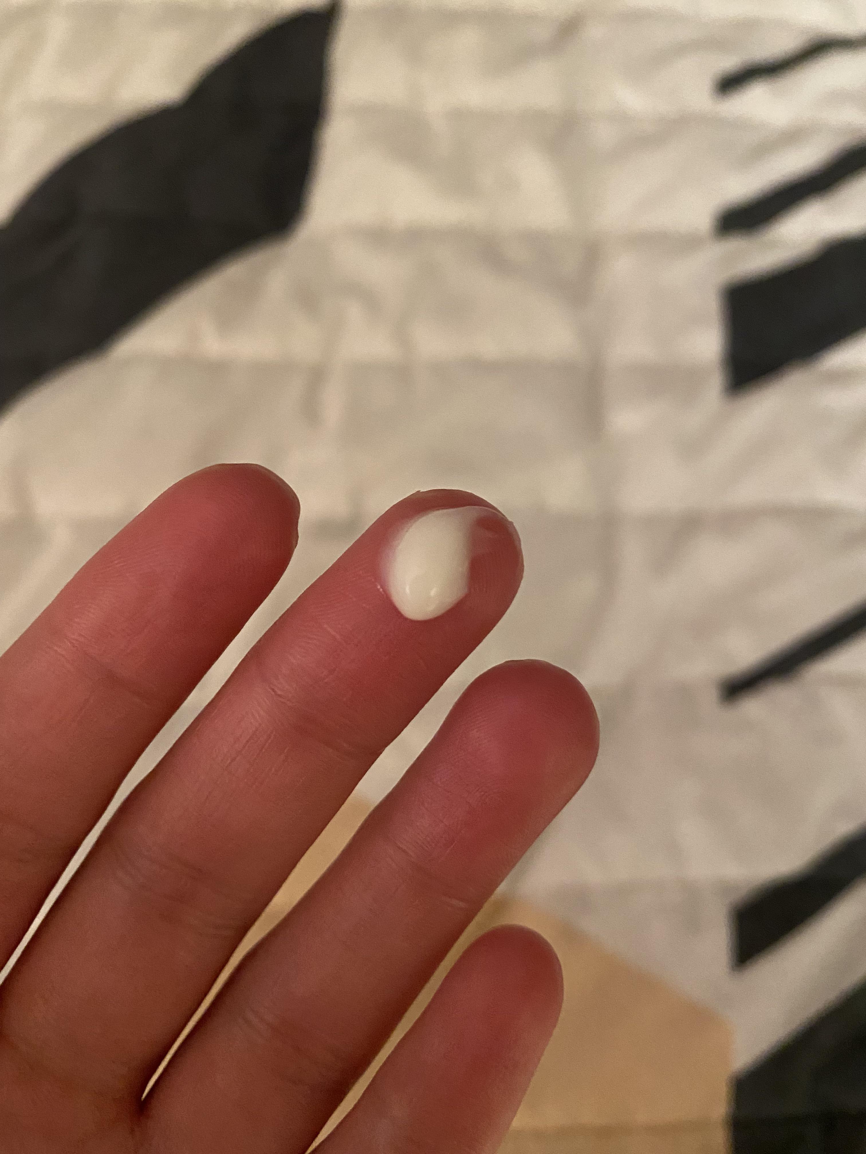 Does this look like the right amount? My dermatologist didn't tell me how  much to use or anything : r/tretinoin