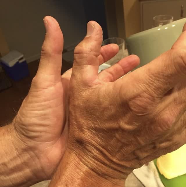 r/mildlyinteresting - a close up of hands